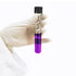 40pcs Glass Serological Test Tubes with Black Bakelite Screw Caps, 15ml 16x150mm, Borosilicate Glass