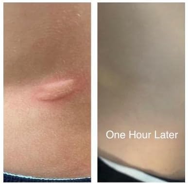 Topical Probiotic Spray for Kids and Teens, Organically and Pediatrician Approved, Non-GMO, Hypoallergenic, & Vegan 4