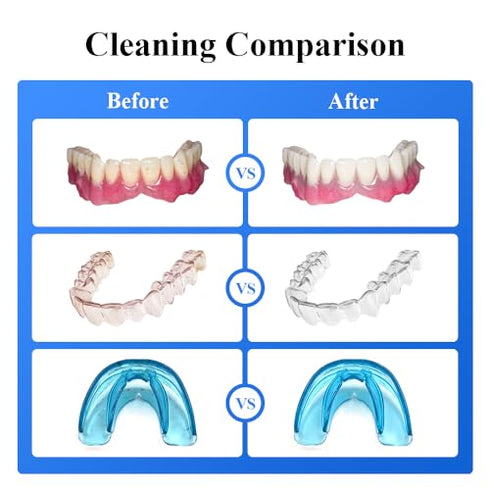 Tullker Ultrasonic Retainer Cleaner, 25W, 42kHz, Portable Professional for Dentures, Aligners, Jewelry
