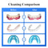 Tullker Ultrasonic Retainer Cleaner, 25W, 42kHz, Portable Professional for Dentures, Aligners, Jewelry