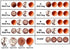 Eldoncard Blood Typing Kit, 5 Test Pack for Accurate Instant Home Testing of Blood Type