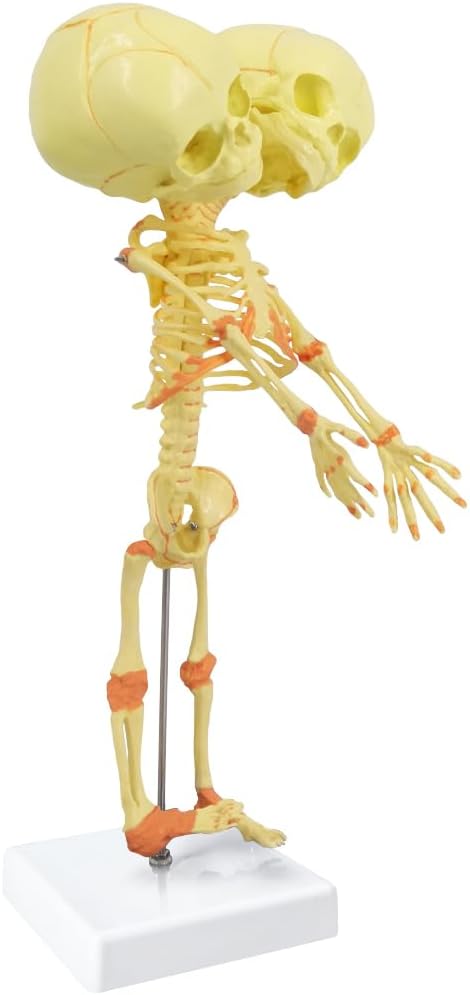 EVOTECH SCIENTIFIC Human Infant Skeleton Model, Twin-Skull, Human Fetus Skeleton W/Double-Skull Model for Medical Study