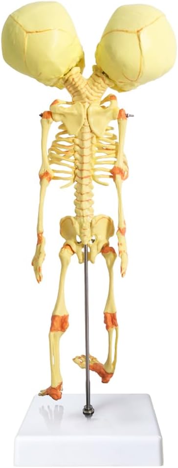 EVOTECH SCIENTIFIC Human Infant Skeleton Model, Twin-Skull, Human Fetus Skeleton W/Double-Skull Model for Medical Study