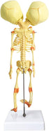 EVOTECH SCIENTIFIC Human Infant Skeleton Model, Twin-Skull, Human Fetus Skeleton W/Double-Skull Model for Medical Study