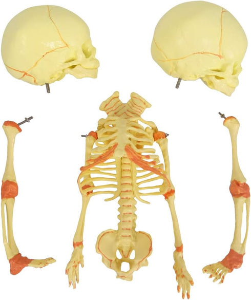 EVOTECH SCIENTIFIC Human Infant Skeleton Model, Twin-Skull, Human Fetus Skeleton W/Double-Skull Model for Medical Study