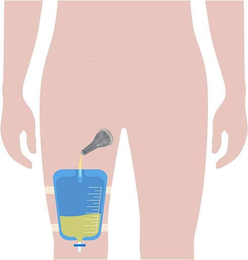 5 5 750ml 5.9 inch 15 cm 30 mm 1.2 Inches) Complete Kit Urinary Days Condom Catheters External Self-Sea + Leg Bag +