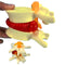 Human Anatomical Lumbar Disc Herniation Model, 1.5 Times Life Size for Teaching and Learning