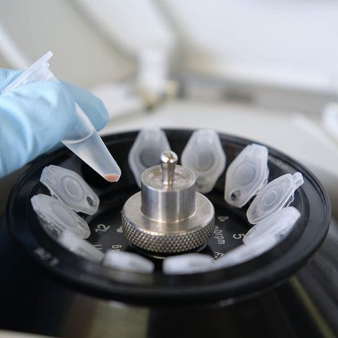 1.5ml Microcentrifuge Tubes 500pcs, EO Sterilized Plastic Vials with Caps for Sample Storage without Leakage