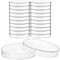 20 Pcs Plastic Petri Dishes with Lids, 60x15mm Sterile Culture Dishes