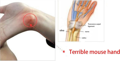 Ergonomic Wrist Rest Bean Bag for Computer Mouse, Memory Foam Support Pillow for Pain Relief of Tendinitis, Carpal
