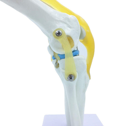 1:1 Knee Joint Simulation Model Medical Anatomy Human Life Size