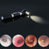 Mini Ear Otoscope, Bysameyee Diagnostic Ear Scope with LED Light, Ear Healthy Tool for Adults, Kids, Pets