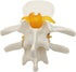 Lumbar Disc Herniation Spine Model - Anatomical Human Intervertebral Disc, 1.5X Magnification for School Teaching, Lab