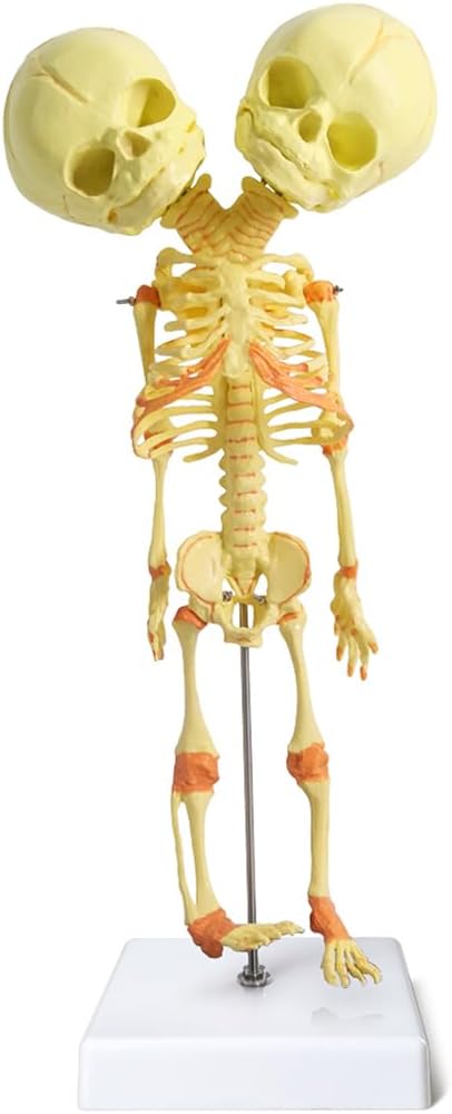 EVOTECH SCIENTIFIC Human Infant Skeleton Model, Twin-Skull, Human Fetus Skeleton W/Double-Skull Model