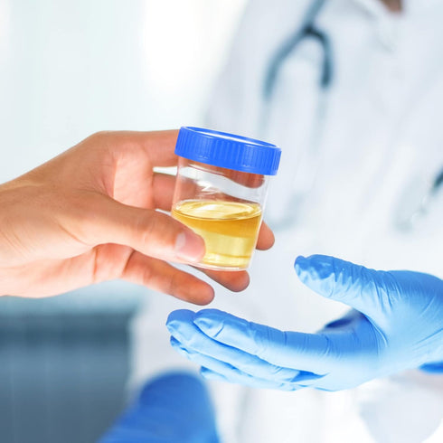 50PCS Specimen Container Cups, Seal Sample Collection Cup for Urine, Screw Urine Sample Cups for Lab Use (40ml)