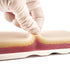 4 3 Medarchitect Venipuncture IV Injection Training Pad Model with Veins Imbedded and Skin Layers for Medical Students