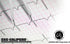 EMI Basix EKG Caliper and EKG Ruler Combination Set EKR-203