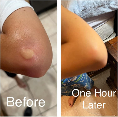 Topical Probiotic Spray for Kids and Teens, Organically and Pediatrician Approved, Non-GMO, Hypoallergenic, & Vegan 4