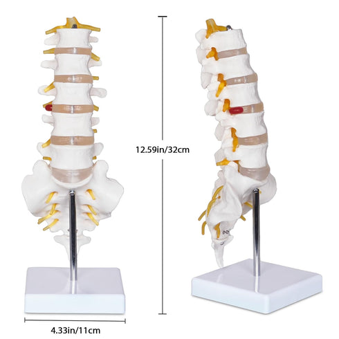 NLShan Scientific Lumbar Spine Model with 5 Vertebrae, Life Size Human Anatomy Model for Classrooms and Offices