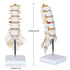 NLShan Scientific Lumbar Spine Model with 5 Vertebrae, Life Size Human Anatomy Model for Classrooms and Offices