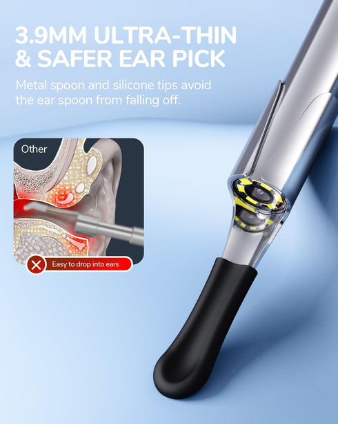 ScopeAround 1080P 3.9mm 6 Otoscope with Light, FHD Ear Scope, Digital Otoscope Camera with LED Lights Ear Wax Removal