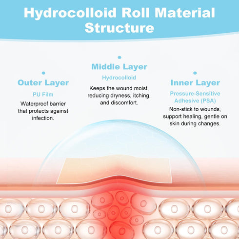 LNHMHN (2in 12ft) Hydrocolloid Roll Bandages, Extra Long Cut-to-Size Pimple Patch Tape for Face & Body, Ultra Absorbent