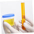 30pcs PRETYZOOM Disposable Sputum Cups Lids Specimen Collection Cups for Pregnancy Tests Lightweight Portable Sterile