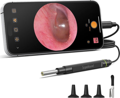 ScopeAround Otoscope with Light, 1080P FHD Ear Scope, 3.9mm Digital Otoscope Camera with
