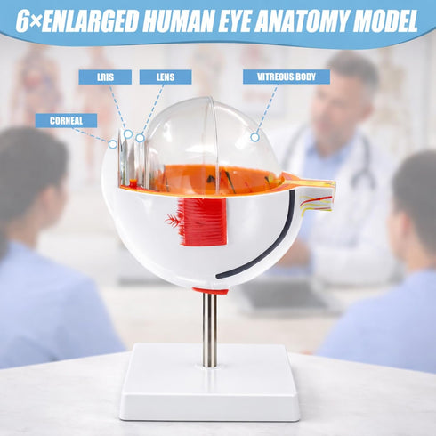 6X Eye Anatomy Model, Enlarged Eyeball Model, Human Eye Anatomical Model for Science Education Students Study Display