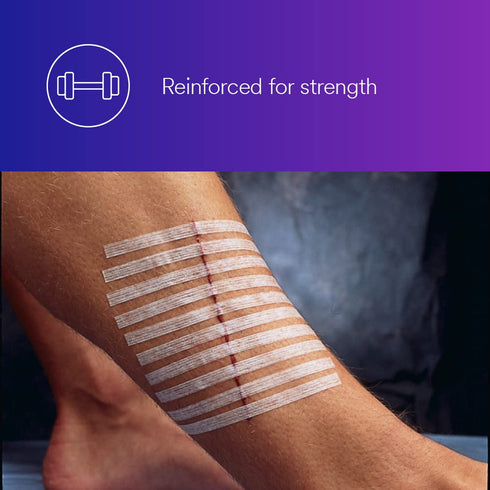 Steri-Strip 3M R1547, 1/2 4 (12 mm 100 mm), 50 4 Reinforced Adhesive Skin Closures, in x in x Bag/Carton, Carton/Case
