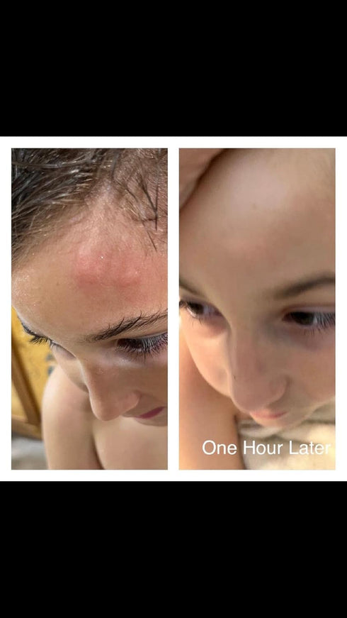Topical Probiotic Spray for Kids and Teens, Organically and Pediatrician Approved, Non-GMO, Hypoallergenic, & Vegan 4
