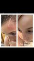 Topical Probiotic Spray for Kids and Teens, Organically and Pediatrician Approved, Non-GMO, Hypoallergenic, & Vegan 4