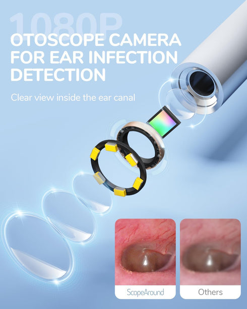 ScopeAround 1080P 3.9mm 6 Otoscope with Light, FHD Ear Scope, Digital Otoscope Camera with LED Lights Ear Wax Removal