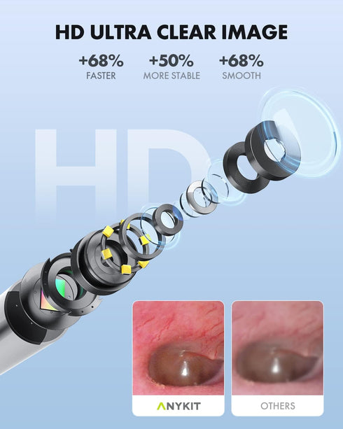 Wireless Otoscope Ear Camera with Dual View, 3.9mm 720PHD WiFi Ear Scope for Kids and Adults, Compatible with Android