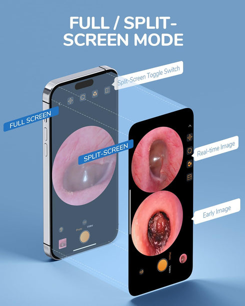 ScopeAround 1080P 3.9mm 6 Otoscope with Light, FHD Ear Scope, Digital Otoscope Camera with LED Lights Ear Wax Removal