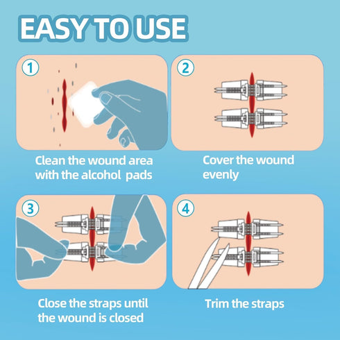 10 Pcs Wound Closure Kit | Upgraded Butterfly Bandages & Zip Stitch Strips for Strong, Scar-Reducing Repair - No Needle