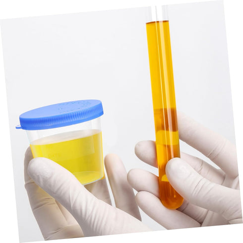 30Pcs Sputum Cups with Covers Sample Containers for Laboratory Testing Lightweight and Convenient Random Color