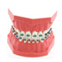 Typodonts Orthodontics Demonstration Model - Metal Wires and Bracket Teaching Model for Adults and Children