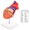 LYOU Human Heart Model, 2-Part Life Size Anatomically Accurate Numbered Heart Medical
