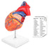 LYOU Human Heart Model, 2-Part Life Size Anatomically Accurate Numbered Heart Medical