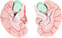 Yosoo Health Gear Human Brain Model Anatomy, Detachable Neuroscience Study Mold for Kids with Skull School Home