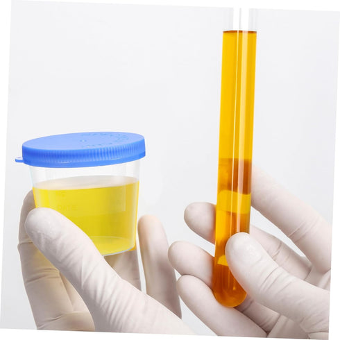 30Pcs VOSAREA Disposable Sputum Collection Cups Random Color Specimen Containers with Lids for Medical Tests Leak