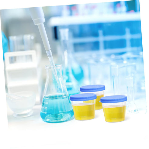 30Pcs VOSAREA Disposable Sputum Collection Cups Random Color Specimen Containers with Lids for Medical Tests Leak