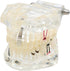 Dental Oral Typodont Model, Implant Pathological Removable Teaching Demo, Standard Size (Clear)