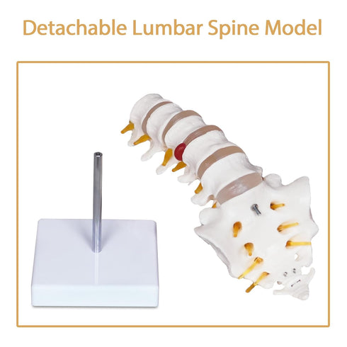 NLShan Scientific Lumbar Spine Model with 5 Vertebrae, Life Size Human Anatomy Model for Classrooms and Offices