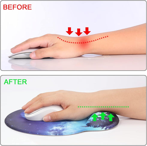 Ergonomic Mouse Pad with Wrist Support Rest, Large Gel Mousepad with Coaster for Pain Relief at Home & Office - Forest