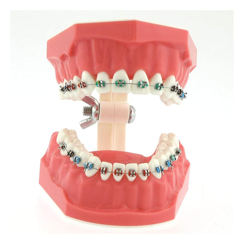 Typodonts Orthodontics Demonstration Model - Metal Wires and Bracket Teaching Model for Adults and Children