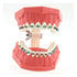 Typodonts Orthodontics Demonstration Model - Metal Wires and Bracket Teaching Model for Adults and Children