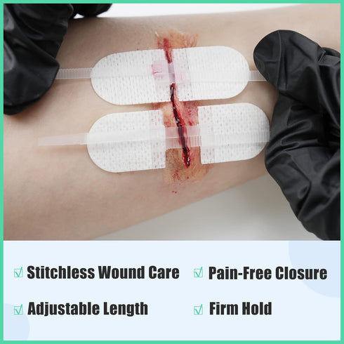6pcs RHINO RESCUE Wound Closure Kit, with Dresssings, Wound Closure Strips Without Suture, Stitch Zip Laceration