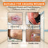 7.2''x7.2''(18cm x18cm) 5 Carbou Silicone Wound Care Products, Bordered Silicone Adhesive Sacral Foam Dressing,Silicone